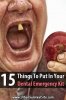 15-things-to-put-in-your-dental-emergency-kit-pin-2.jpg